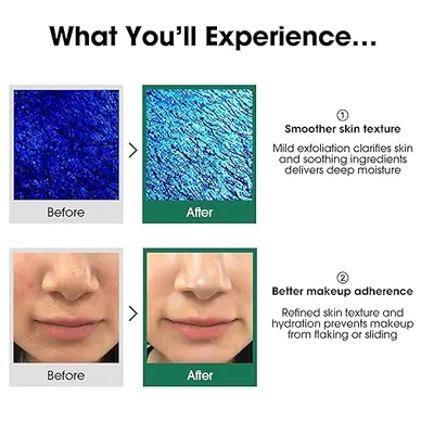 Niacinamide ও sunscreen: বাংলাদেশে beginner-এর morning layer, patch test ও patience guide