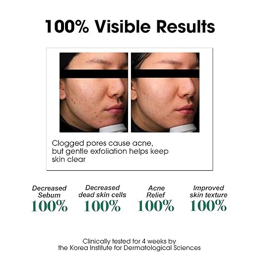 Some By Mi AHA-BHA-PHA 30 Days Miracle Toner (150ml) 5